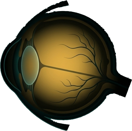 Vision Loss